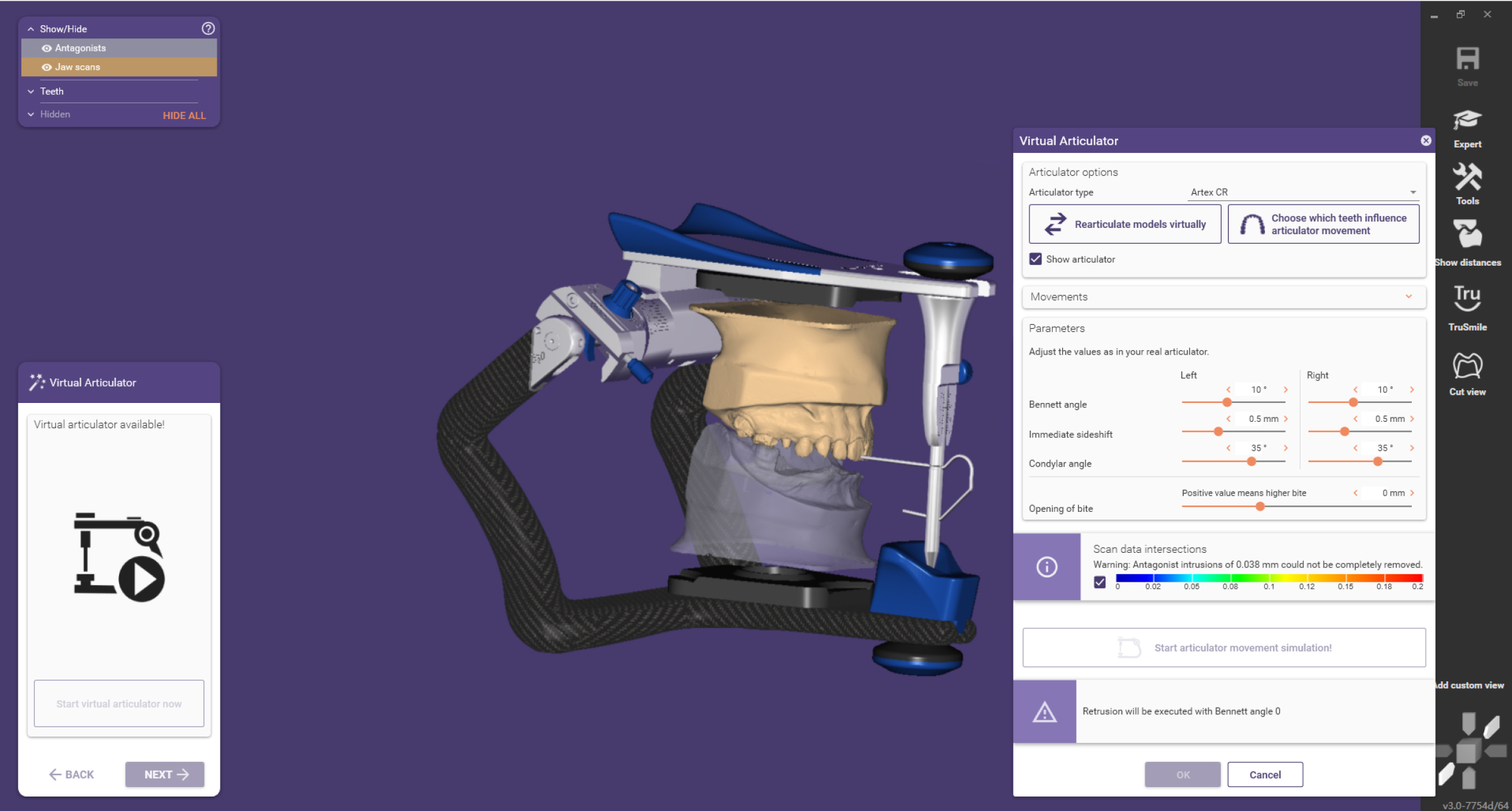 Virtual Articulator Transfer